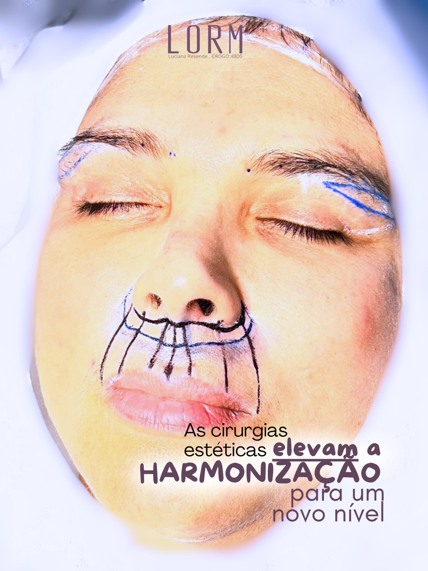 A harmonização orofacial evolu… A harmonização orofacial evolu…